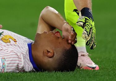 Kylian Mbappé tumbado en el césped tras recibir el impacto que le ocasiona una herida en el tabique nasal.