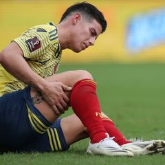 "James, una presa fácil en la derrota de Colombia"