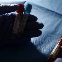 Coronavirus en Chile: ¿cuáles son las comunas con más casos en la Región Metropolitana?