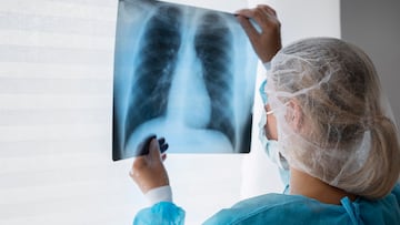 Acude al hospital, acaba con una discapacidad del 67% y la Justicia tumba la indemnización de 220.000 euros por mala praxis