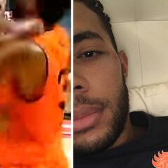 Así le dejó la cara Gallinari a Jito Kok: "Se llevó la peor parte"