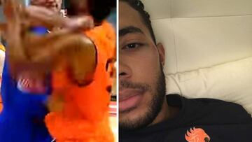 Así le dejó la cara Gallinari a Jito Kok: "Se llevó la peor parte"