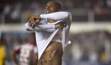 Las cicatrices de guerra en la carrera de Jonathan Copete