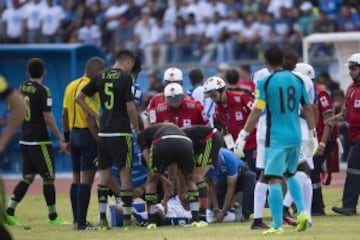 El mediocampista hondureño sufrió una impactante lesión, luego de que Javier Aquino le cayó encima de la pierna en una jugada sin intención en el duelo de Concacaf.

