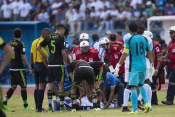 El mediocampista hondureño sufrió una impactante lesión, luego de que Javier Aquino le cayó encima de la pierna en una jugada sin intención en el duelo de Concacaf.