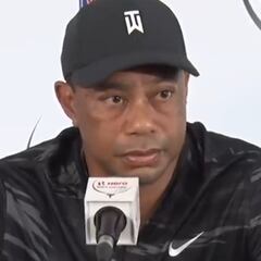 La reacción viral de un periodista cuando Tiger le dice que la amputación fue una opción real