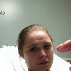 Rousey se recupera de un espeluznante corte en un dedo