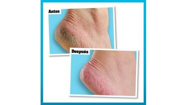 ¿Pies y talones agrietados? Esta crema lo soluciona en dos días