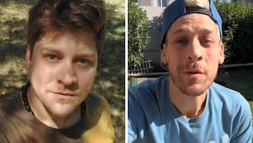 “Me tomé unos tragos, comencé a comer cosas que no debía; sí se operan, no sean tontos como yo”