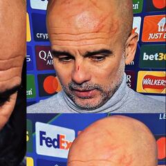 Guardiola y sus rasguños: “Lo hice yo, con mi uña, quería herirme”