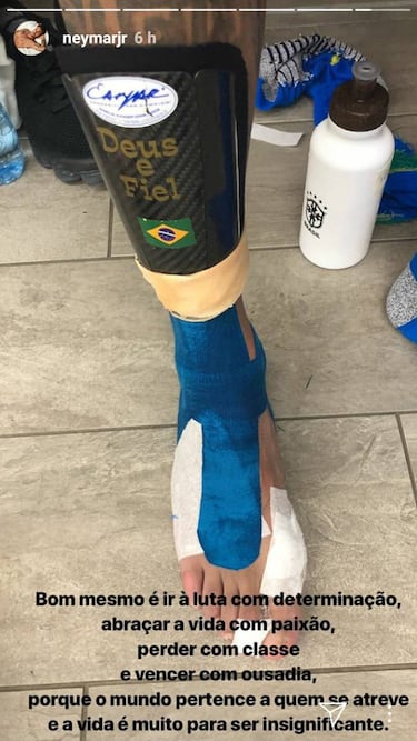 Neymar enseña en Instagram el estado de su pie lesionado
