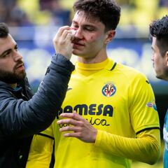 Cuenca termina en el hospital por una fractura nasal