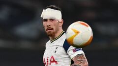 Hojbjerg da la razón a Simeone