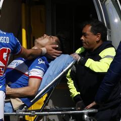 'Gato' Silva sufre fractura de tibia y peroné ante La Calera