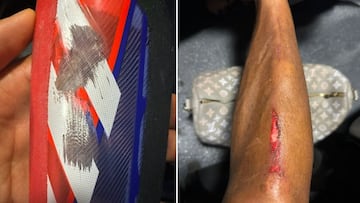 El estado en el que quedó la espinillera de Reinildo tras el golpe y la herida en su pierna.
