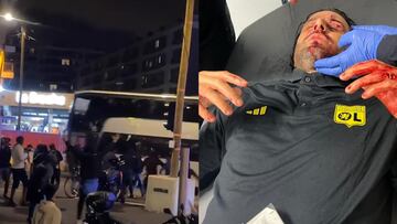 Autobús de Lyon es apedreado en su llegada a Marsella dejando herido al entrenador