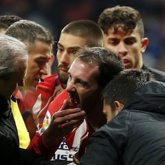 Los defensas de Simeone suman 195 días de baja