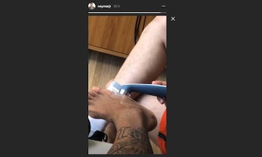 Neymar muestra el bulto de su tobillo en Instagram