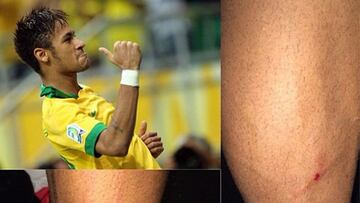 Neymar se quejó de la dureza de Honduras: "Logré salir vivo"