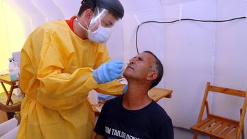 Otro problema a la vista: mucho retraso en recibir el resultado de los test PCR