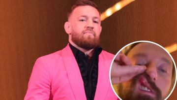 Conor McGregor es acusado de violencia física. Francesco Facchinetti, famoso DJ italiano, acusa a Notorious de haberlo golpeado sin razón: "Es violento".