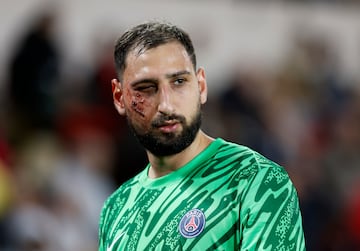 Wilfried Singo jugador del Mónaco golpeó con la bota el rostro de Donnarumma, el guardameta italiano fue atendido en el terreno de juego y no pudo continuar en el terreno de juego.