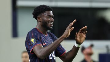 Patrick Agyemang dejó a Charlotte y la MLS para emigrar a Europa con el Derby County, pero una cirugía puede hacer que se retrase su debut.