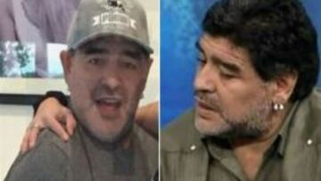 Maradona, antes y despu&eacute;s de la operaci&oacute;n est&eacute;tica