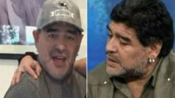 Maradona, antes y despu&eacute;s de la operaci&oacute;n est&eacute;tica