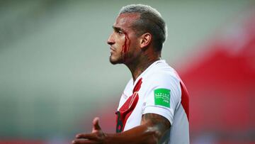 Peru&#039;s Miguel Trauco bleeds during the 2022 FIFA World Cup South American qualifier football match against Brazil at the National Stadium in Lima, on October 13, 2020, amid the COVID-19 novel coronavirus pandemic. (Photo by Daniel APUY / various sour