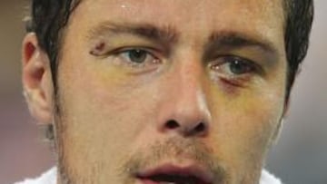 <b>TENISTA PELEÓN.</b> El tenista ruso Marat Safin ha admitido su participación en una reyerta la semana pasada en Moscú, lo que obligó a retrasar su partido de la Copa Hopman que se disputa en Australia.