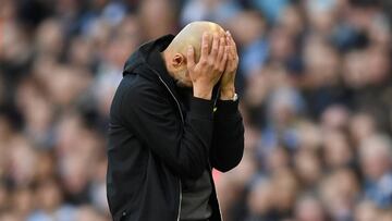 El entrenador Pep Guardiola ha perdido gran parte del pelo.