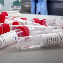 ¿Por qué Campeche ha logrado pasar al semáforo amarillo?