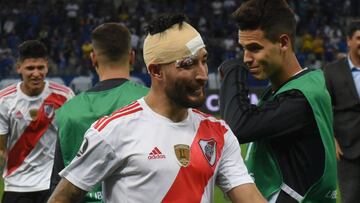 Casco: "Siempre tenemos que estar a la altura"