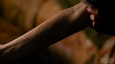 The Last of Us season finale finally reveals how Ellie was immune to Cordyceps