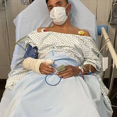 Purito sufre una fuerte caída haciendo mountain bike