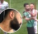 ¡Insólito! Este jugador salió con un cuchillo y cortó a varios rivales