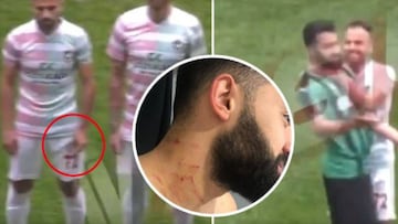 Un futbolista salió al campo con una cuchilla escondida en la mano y rajó a varios rivales