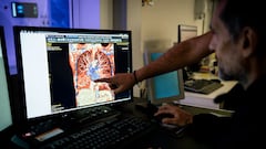 El potencial de la IA para mejorar nuestra salud que ya está demostrando extraordinarias aplicaciones