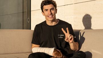 Marc Márquez posa tras su operación del síndrome compartimental.