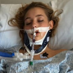 Publica las fotos de su hija en coma para concienciar de los peligros del alcohol