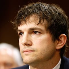 Ashton Kutcher, a punto de perder la vista y el oído por una rara enfermedad