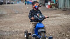 Coronavirus en Perú: primeros casos de niños con síntomas de Síndrome de Kawasaki