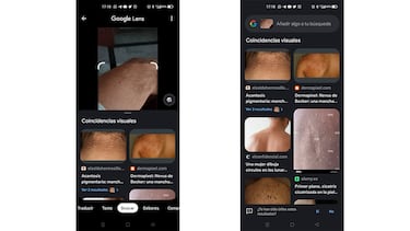 Cómo detectar enfermedades en la piel de manera rápida con tu móvil