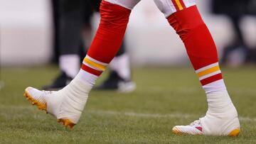 Chiefs quarterback Patrick Mahomes suffered a high ankle sprain in the AFC title game, leaving some concerns leading up to the Super Bowl this weekend.