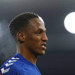 Yerry Mina deja el partido ante el City por lesión