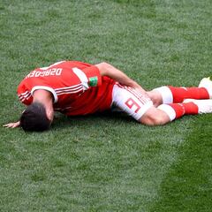 Dzagoev tardará diez días en recuperarse de la lesión