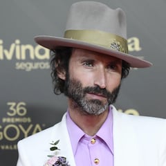 El “traumático” accidente con el que Leiva perdió el ojo