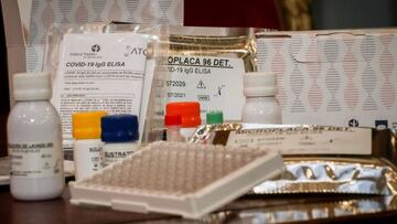 AME4859. MONTEVIDEO (URUGUAY), 28/07/2020.- Fotografía que muestra kit de exámenes serológicos este martes, en Montevideo (Uruguay). Científicos uruguayos lograron desarrollar y producir 50.000 test serológicos de COVID-19 que permitirán detectar si los pacientes contagiados desarrollaron anticuerpos contra el coronavirus y cuál es el alcance real de la extensión de la enfermedad en el país. EFE/Raúl Martínez