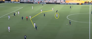 Xabi saca el bisturí